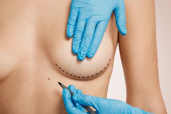 Cancer screening